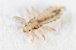 head lice 